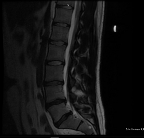 1de1a6_16b370a802114ba3b4743e3abf45798b_mv2