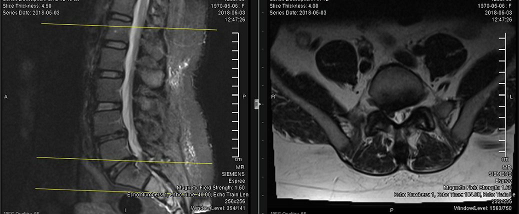 1de1a6_235ce66a89854c359030418379d90d05_mv2