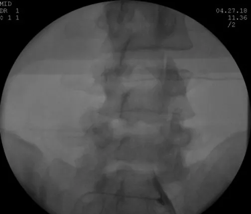 1de1a6_3b271597c6cd435db44b24bbe0d7f15b_mv2