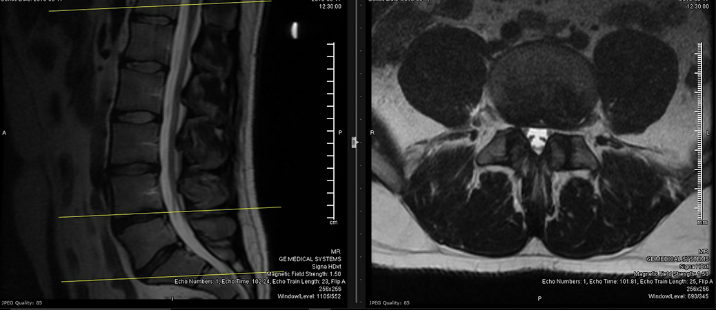 1de1a6_3c295baa002c4c46b120c6b39a6f3a6e_mv2