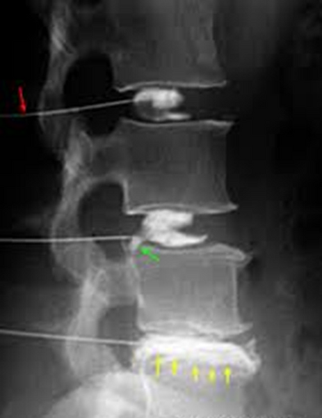 1de1a6_41e17ceef6974027ac9bf1bbcd8119f7_mv2