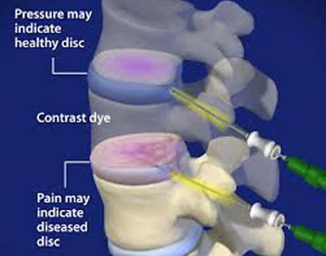 1de1a6_531cbfab4e064445920c2b76270906a5_mv2