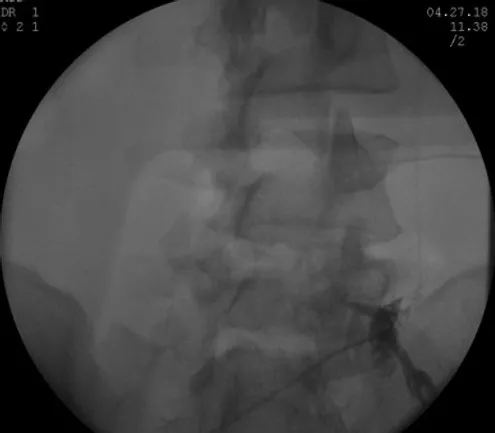 1de1a6_acf06e1f1b3a43c5bebed6d84110a630_mv2