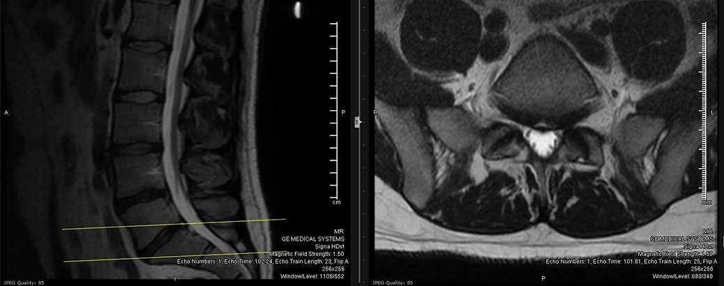 1de1a6_d8c64f58751d408299f764077b1adbc7_mv2