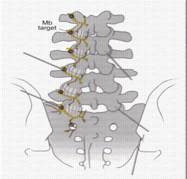 1de1a6_dcb02e4f182b4842a554d5c544bb9747_mv2